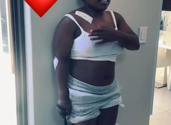 Makhadzi Discharged After Horrific Car Accident, Faces 10-Week Break from Stage Performances