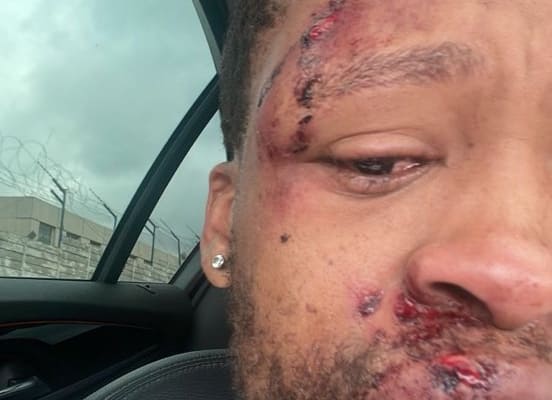 A Night Out Turns to Brutality: Viral Assault on Ntokozo Michael Ngwenya Sparks Outcry Over Nightclub Security