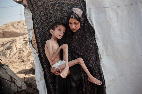 Gaza Health Ministry: 453 Dead from Famine, Including 150 Children