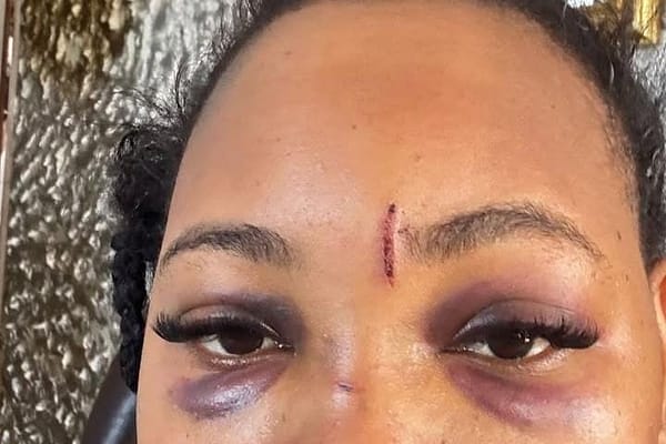 Durban Hairstylist Breaks Silence on Alleged Abuse Amid GBV Crisis